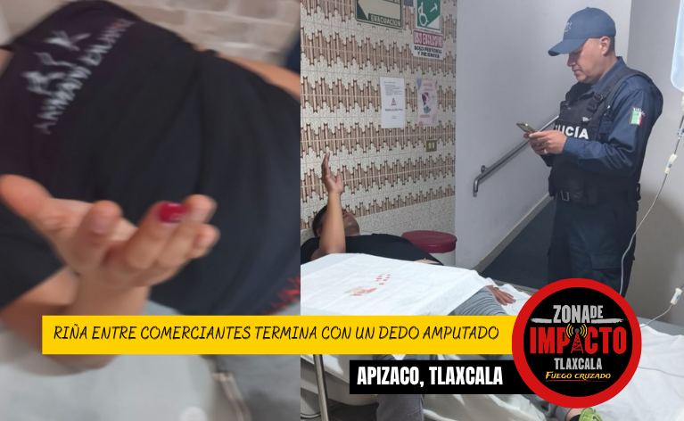 ¡A MORDIDAS! RIÑA ENTRE COMERCIANTES TERMINA CON UN DEDO AMPUTADO EN APIZACO